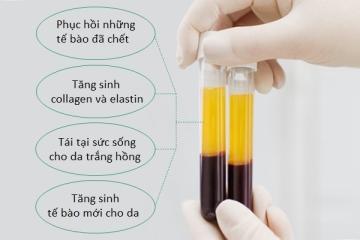 HUYẾT TƯƠNG GIÀU TIỂU CẦU PRP- TRẺ HÓA VƯỢT THỜI GIAN